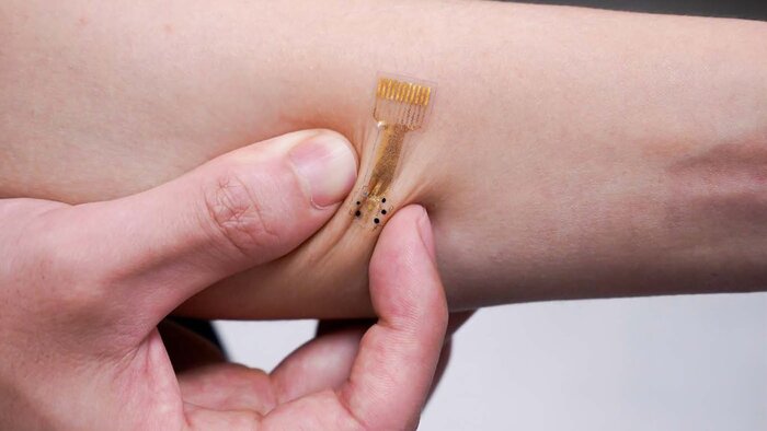 ساخت بانداژ هوشمندی که وضعیت زخم را به پزشک گزارش میدهد