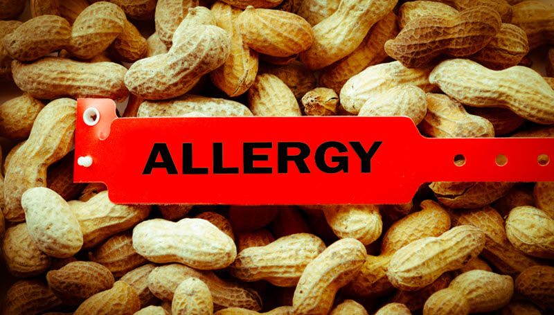 موفقیت در درمان آلرژی به بادام زمینی با کمک فناورینانو