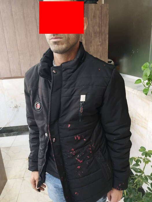 اسیدپاشی در خیابان دامپزشکی تهران / متهم دستگیر شد