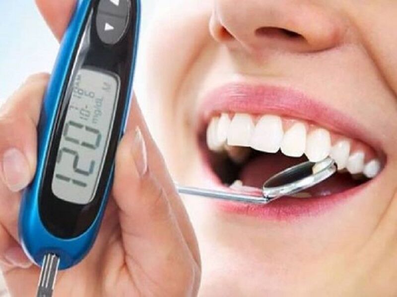 یک استاد دانشگاه: معاینات دندانپزشکی یکی از راههای تشخیص دیابت است 
