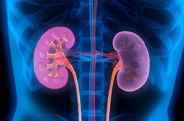 بیماریهای کلیوی، تهدید خاموش سلامتی