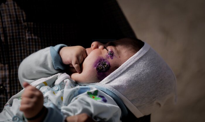 خطر بازگشت «سالَک» در دامغان با آغاز فصل گرما و افزایش تعداد جوندگان