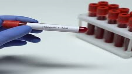 تامین کیتهای بیولوژی مولکولی مورد نیاز آزمایشگاهها به همت دانش بنیانها