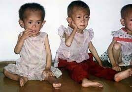 مطالعات جدید: از هر ۵ کودک در کره شمالی یک نفر دچار سوتغذیه است