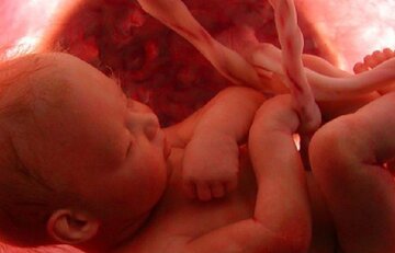 بانوی ۳۰ ساله نیشابوری بر اثر سقط جنین غیر قانونی فوت کرد