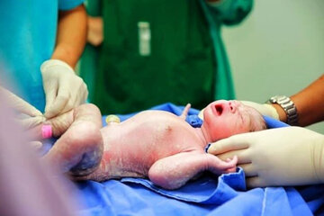 آمار ولادت در آستارا بیش از ۱۱ درصد افزایش داشت