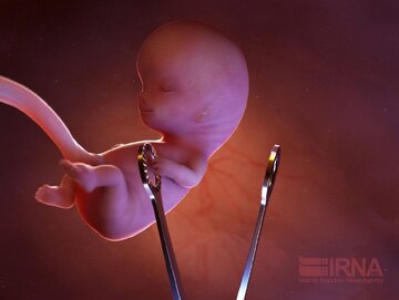 شی‌انگاری و نادیده گرفتن حق حیات، عامل جنایت خاموش سقط جنین عمدی