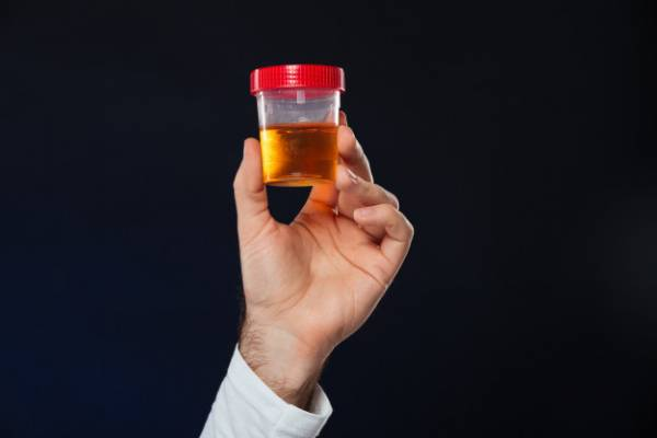 چه عواملی موجب تشکیل سنگ کلیه میشود؟