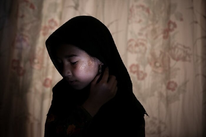 خوزستان در ردیف پنج استان پرشیوع بیماری سالک قرار دارد