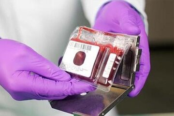 ۲۰۰ نمونه خون بند ناف امسال در کردستان جمع‌آوری شد