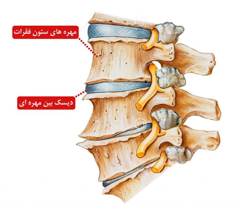 ساخت داربستی برای بافت لیفی دیسک بین مهره‌ای توسط محققان امیرکبیر