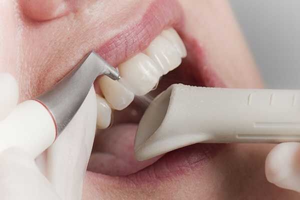 سلامت دهان و دندان مادر چه تأثیری بر جنین می‌گذارد؟