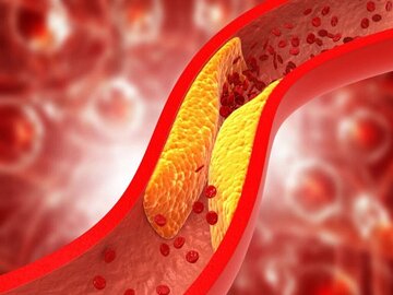 پژوهشگران مشهدی موفق به درمان گرفتگی رگ‌های دیابتی‌ها با کمک سلول‌های بنیادی شدند