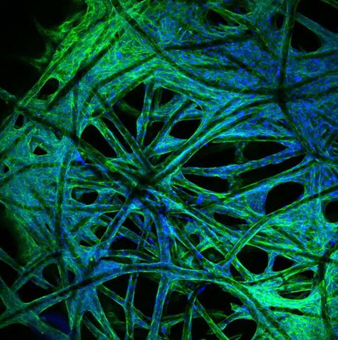 ساخت مدلهای سهبُعدی تومور بیماران برای آزمایش درمان