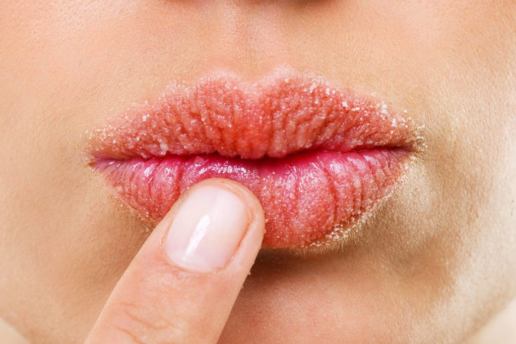 با ترک لب چه کنیم؟