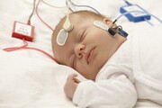 هشدار رواج بیماری «متابولیک نوزادی» در بابل