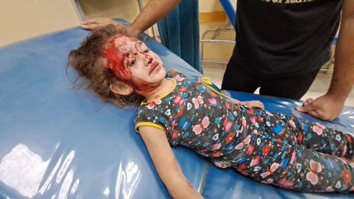 ۷۵درصد شهدای غزه زن و کودک هستند/بمباران بازارها و نانوایی‌ها