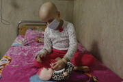 برنامه دولت برای ریشه‌کنی بیماری سرطان در مازندران چیست؟ +فیلم