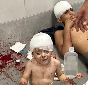۵۰۸۷ شهید در ۱۷ روز بمباران غزه/ ۱۵ هزار و ۲۷۳ مجروح + فیلم