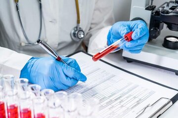 سازمان انتقال خون مکلف به انجام آزمایش غربالگری با روش‌های نوین شد