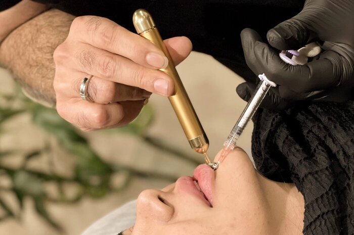 کاهش سن عملهای جراحی زیبایی در کشور/ فریب تبلیغات را نخورید