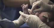 ضعف ارتباط گیری نوزاد با مادر از آسیب های سزارین است
