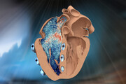 طراحی یک نمونه رباتیک بطن راست قلب