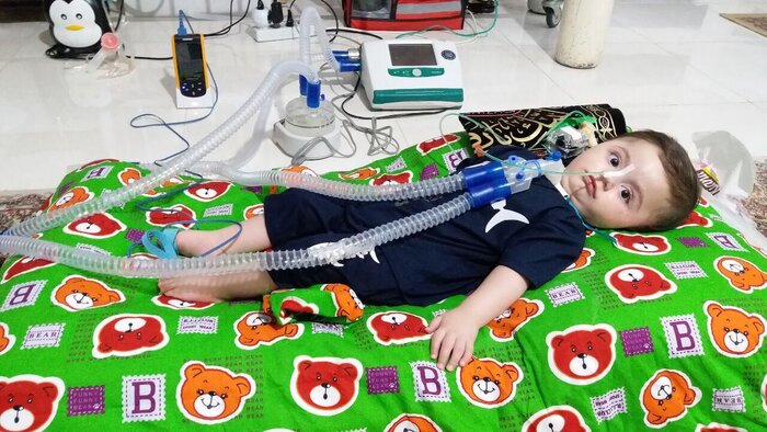 جراحی سینا و حاشیههایش؛ تامین داروی SMA چگونه انجام شد؟