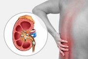 چگونه سنگ کلیه را با روش های کم تهاجمی درمان کنیم؟