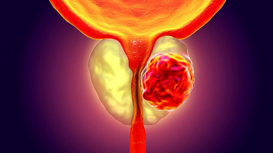 ۷ علامتی که نشان میدهد باید به اورولوژیست مراجعه کنید