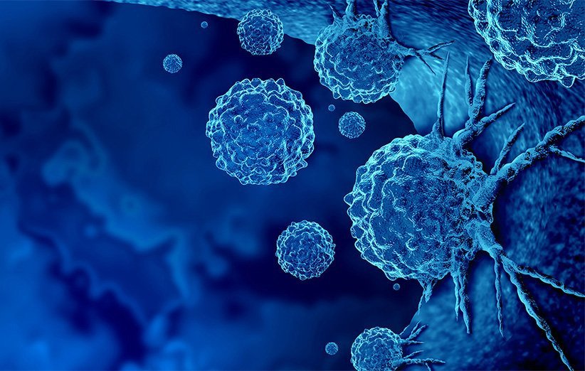 هرآنچه باید در مورد سرطان بدانید