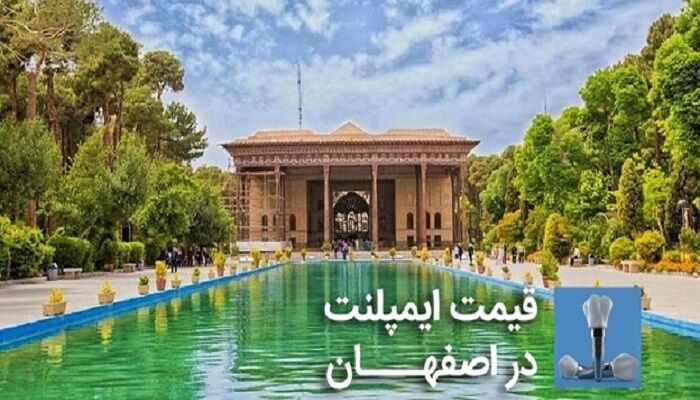 قیمت ایمپلنت در اصفهان