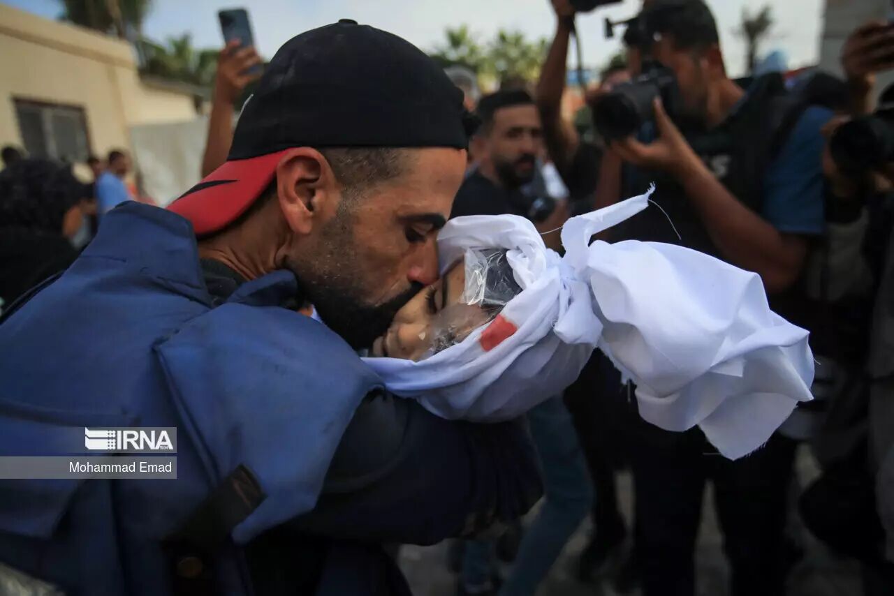 غزہ کی پٹی میں غذائی قلت کے باعث 7 فلسطینی بچوں کی شہادت