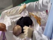 شهادت نوزاد شیرخواره فلسطینی بر اثر گرسنگی + فیلم
