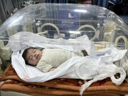 استشهاد طفل فلسطيني برفح بسبب سوء التغذية جراء الحصار الصهيوني