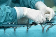 نجات جان ۲ جوان با انجام عمل جراحی مغز در بیمارستان رازی سراوان