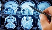 معیارهای انتخاب جراح مغز و دیسک کمر و گردن