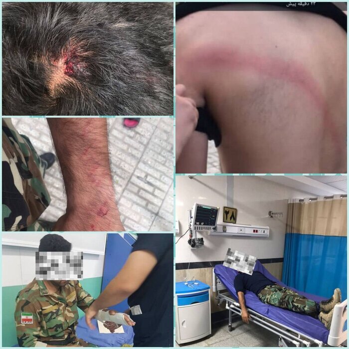 ضرب و شتم یک جنگلبان در نور مازندران ازسوی افراد سودجو 2