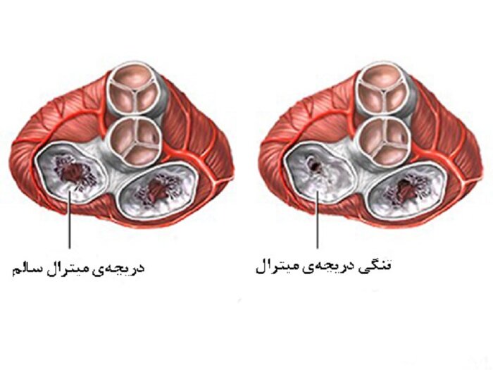 تپش سلامت در سینه جامعه، پیشگیری از بیماری‌های قلبی و عروقی