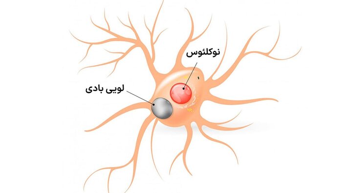 «اثرانگشت» عامل آسیب‌پذیری سلولی مرتبط با پارکینسون شناسایی شد