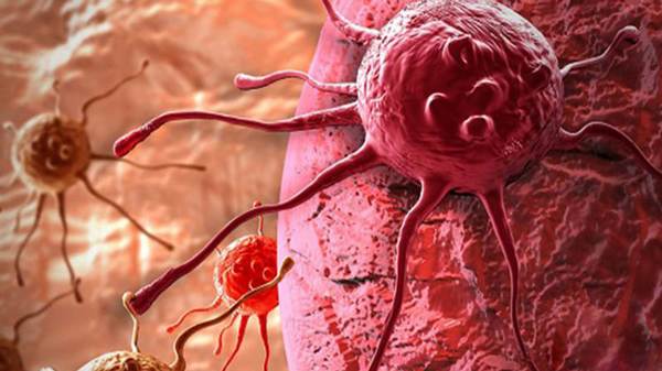 مطالعه سلول به سلول چربی؛ راهی برای تحقیقات جدید سرطان