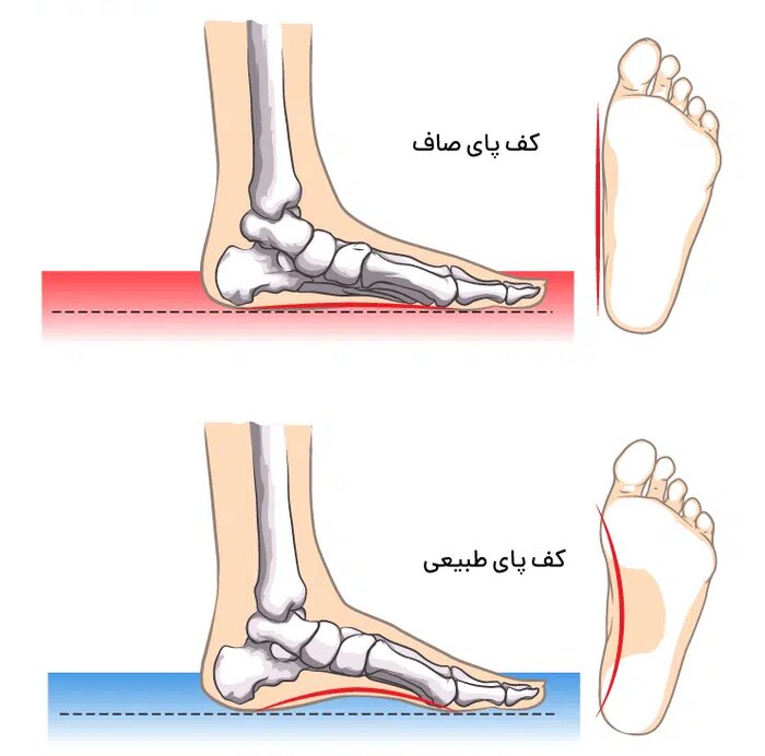 اگر کف پای شما صاف است؛ باورهای قدیمی را دور بریزید