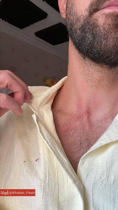 واکنش پلیس به حمله سارقان به مهاجم سابق استقلال تهران