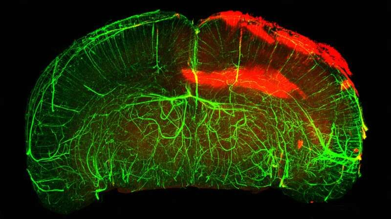 دستیابی محققان به یک هدف درمانی جدید برای کنترل آسیبهای مغزی