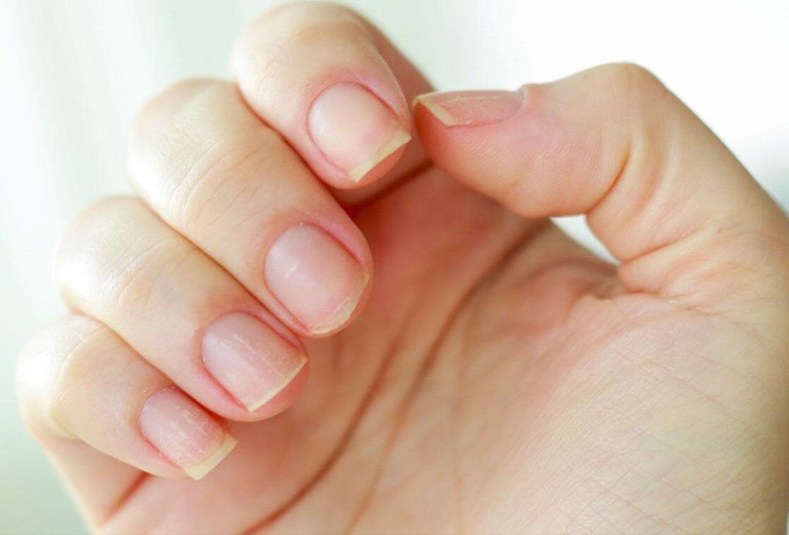 ايران تنتج أدوية دقيقة بوليمرية لعلاج فطريات الاظافر ايران تنتج أدوية دقيقة بوليمرية لعلاج فطريات الاظافر