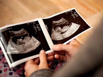مشاوره مناسب، ۳۵ مادر باردار در کاشان را از سقط جنین منصرف کرد
