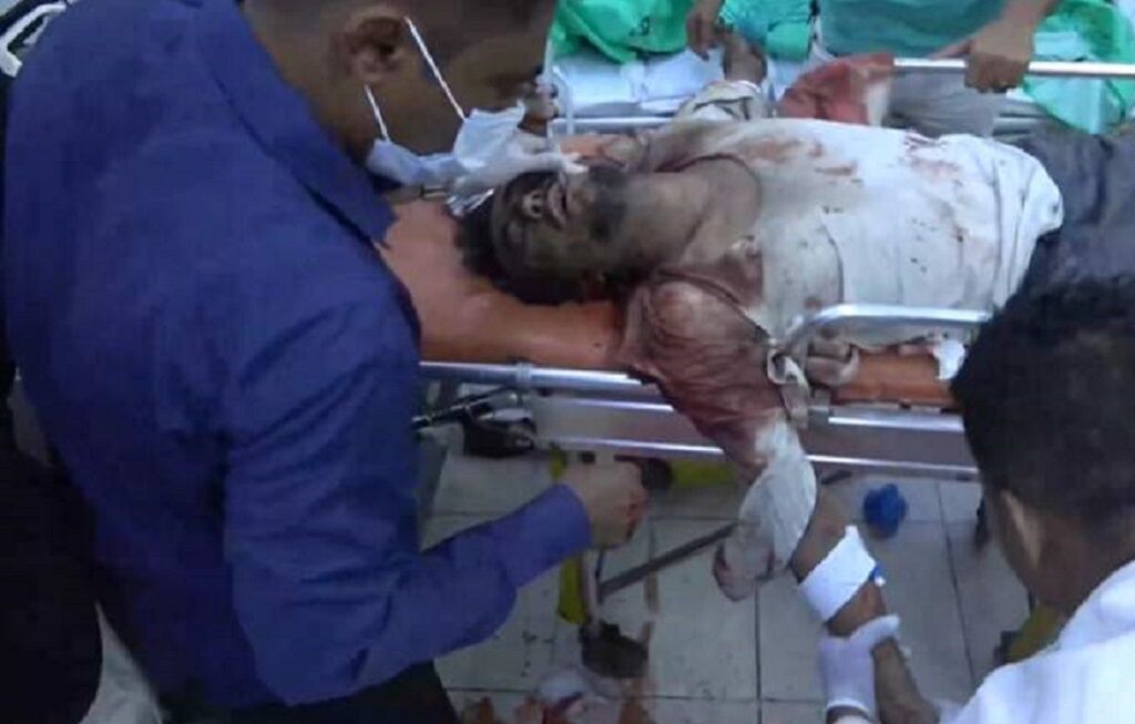 وزارة الصحة اليمنية : 16 شهيداً وأكثر من 30 جريحاً للعدوان الأمريكي - البريطاني على اليمن وزارة الصحة اليمنية : 16 شهيداً وأكثر من 30 جريحاً للعدوان الأمريكي - البريطاني على اليمن