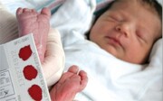 غربالگری تیروئید ۶۰ هزار نوزاد در سال/ضرورت مراجعه زنان باردار به مراکز سلامت
