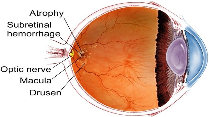 مصرف منظم ملاتونین احتمال بروز بیماری چشمی سالمندی را کاهش می‌دهد