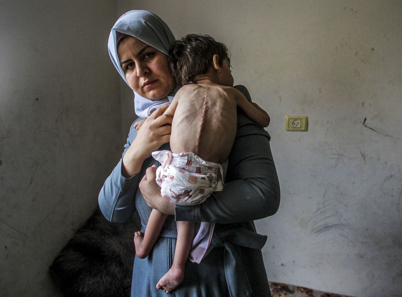 ‘Malnutrition poses danger to pregnant women, newborns in Gaza’ - IRNA ...